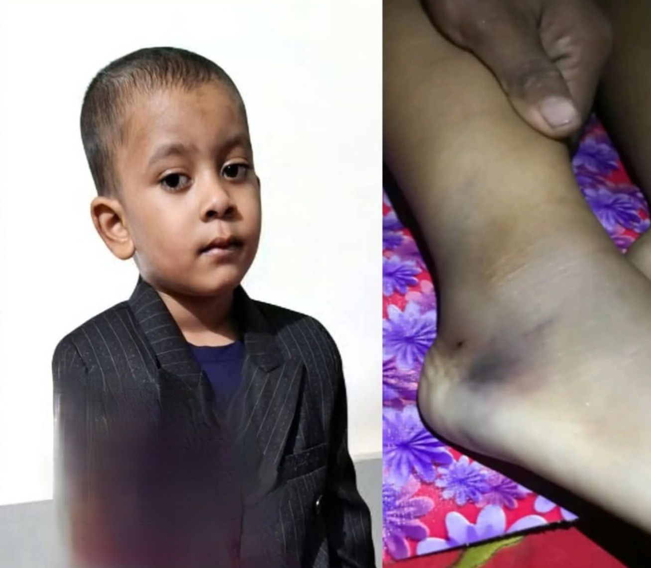 রামগঞ্জে বিষাক্ত সাপের কামড়ে ৫ বছরের শিশুর মর্মান্তিক মৃত্যু: অ্যান্টিভেনমের অভাবে হাসপাতালে কর্তব্যে অবহেলা অভিযোগ