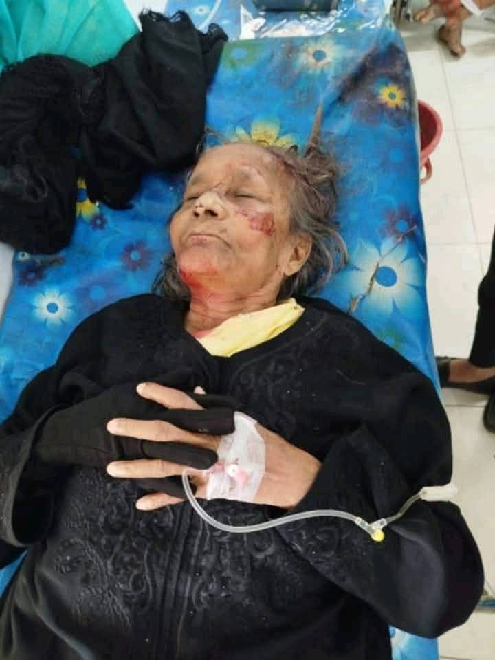 খুঁজে পেতে সহযোগীতা করুন - আজ, ২০ আগস্ট, ২০২৫ চাঁদপুর টেকনিক্যাল হাইস্কুলের সামনে দুপুর ১টার দিকে এক সিএনজির সাথে দুর্ঘটনায় এক বয়স্ক মহিলা আহত হয়েছেন। দুর্ঘটনার পর স্থানীয়রা তাকে দ্রুত উদ্ধার করে চাঁদপুর সদর হাসপাতালে ভর্তি করেন।