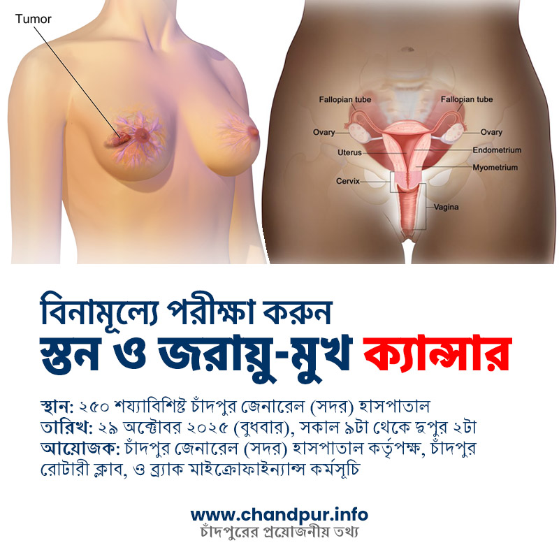 চাঁদপুরে বিনামূল্যে স্তন ও জরায়ু-মুখ ক্যান্সার পরীক্ষা বুধবার